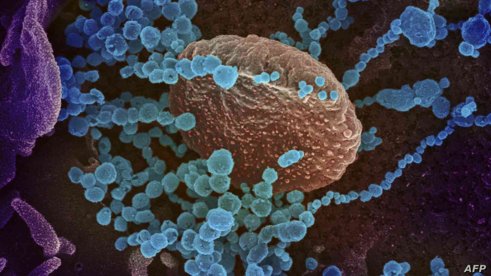 You are currently viewing عالم أمريكي يكشف طريقة اجتثاث فيروس كورونا من جذوره